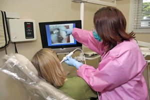 Benefits of intra-oral camera