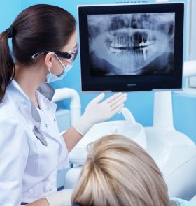 Dental x-ray safety