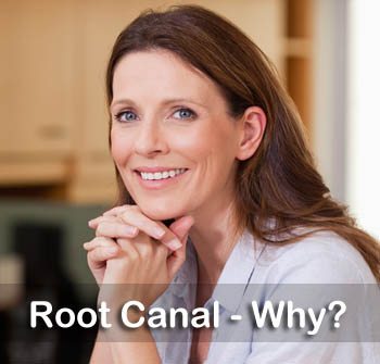 Root Canal explaination