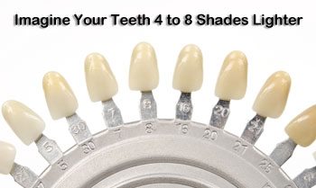 Dental Shade Guide