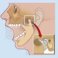 Source of Jaw Pain, TMJ Pain