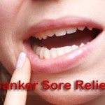 Canker Sore Relief
