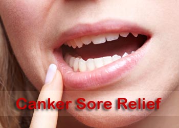 how to get rid of canker sores under tongue